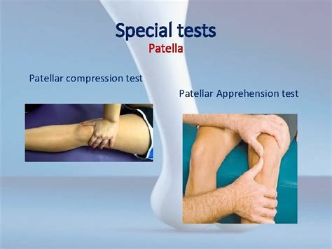 positive patellar compression test|special test for patellar tracking.